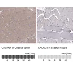 Atlas Antibodies Anti-CACNG4 Antibody
