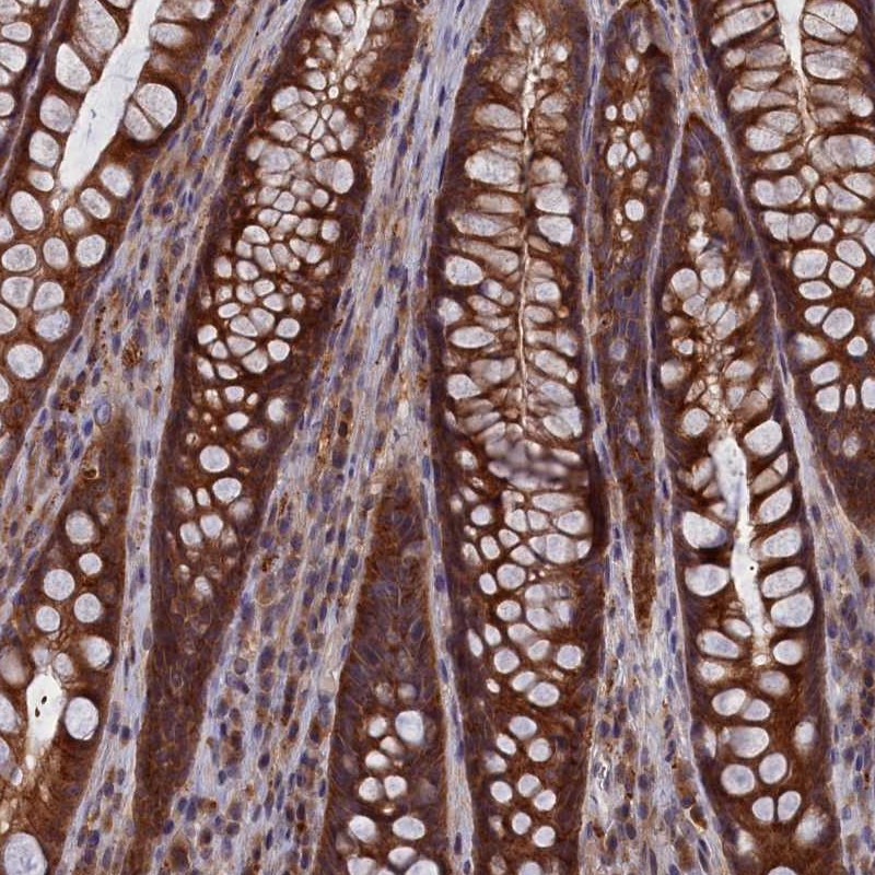 Atlas Antibodies Anti-CACTIN Antibody