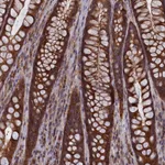 Atlas Antibodies Anti-CACTIN Antibody
