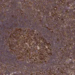 Atlas Antibodies Anti-CAD Antibody