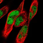 Atlas Antibodies Anti-CACUL1 Antibody