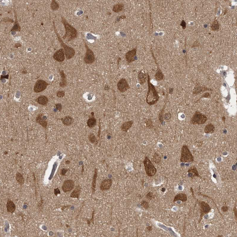 Atlas Antibodies Anti-CACYBP Antibody