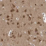 Atlas Antibodies Anti-CACYBP Antibody