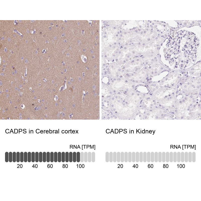 Atlas Antibodies Anti-CADPS Antibody