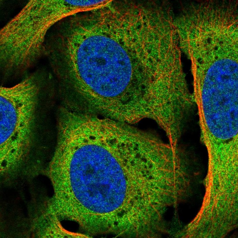 Atlas Antibodies Anti-CACYBP Antibody