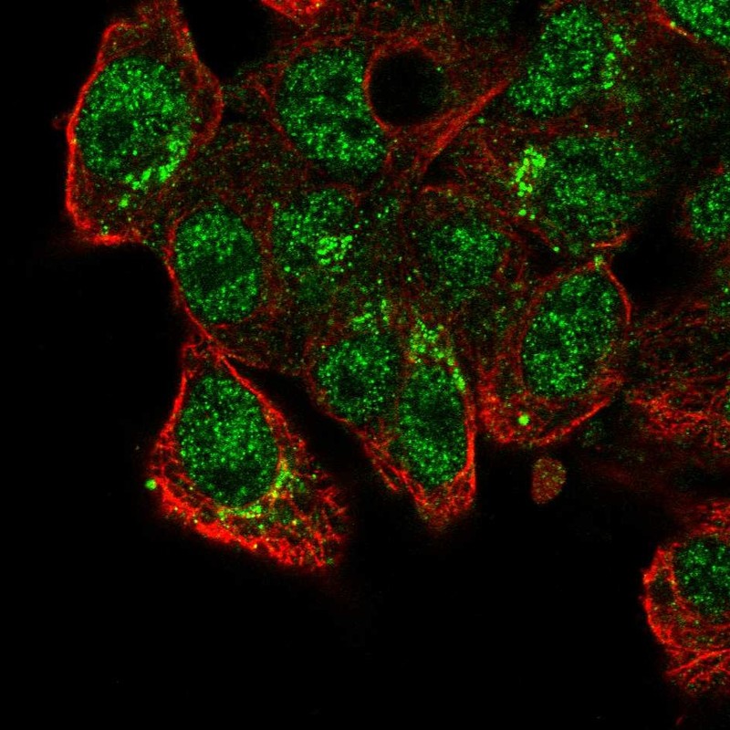 Atlas Antibodies Anti-CADPS2 Antibody