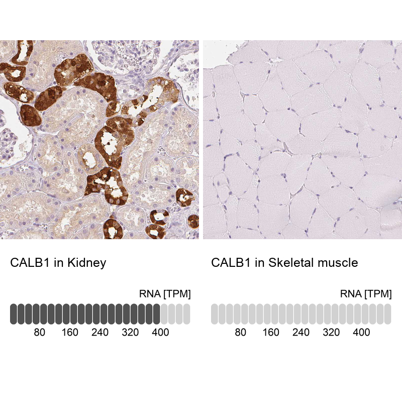 Atlas Antibodies Anti-CALB1 Antibody