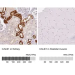 Atlas Antibodies Anti-CALB1 Antibody