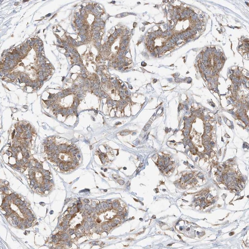 Atlas Antibodies Anti-CAGE1 Antibody