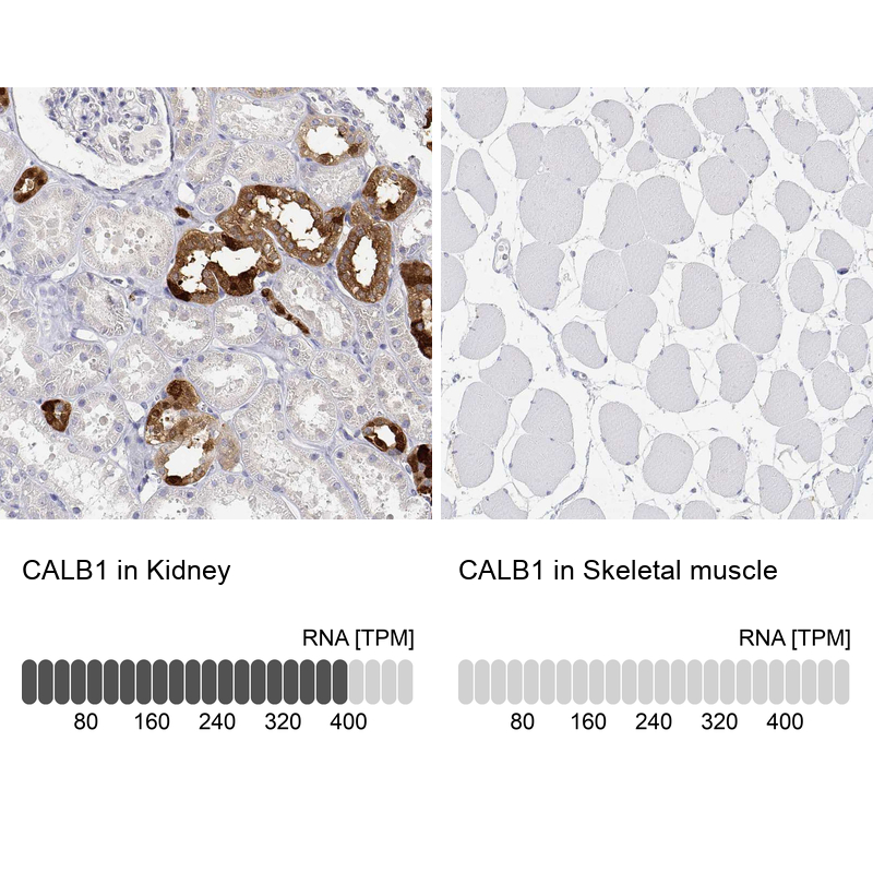Atlas Antibodies Anti-CALB1 Antibody