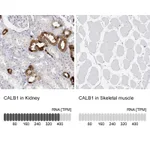 Atlas Antibodies Anti-CALB1 Antibody