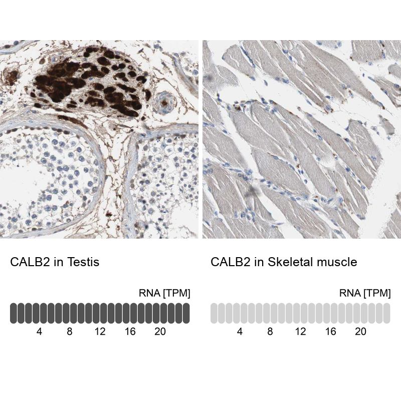 Atlas Antibodies Anti-CALB2 Antibody
