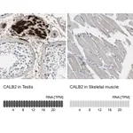 Atlas Antibodies Anti-CALB2 Antibody