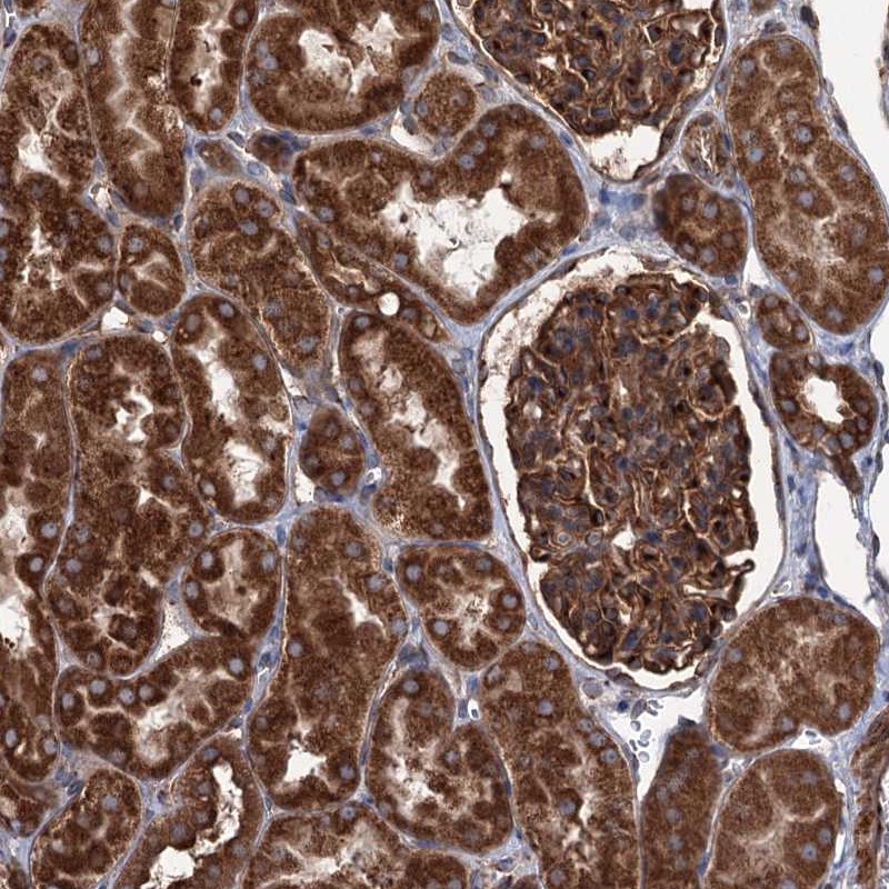 Atlas Antibodies Anti-CALCOCO1 Antibody