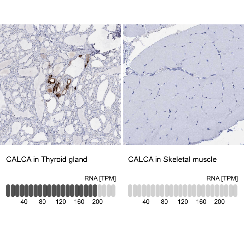 Atlas Antibodies Anti-CALCA Antibody