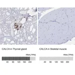 Atlas Antibodies Anti-CALCA Antibody