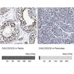 Atlas Antibodies Anti-CALCOCO2 Antibody