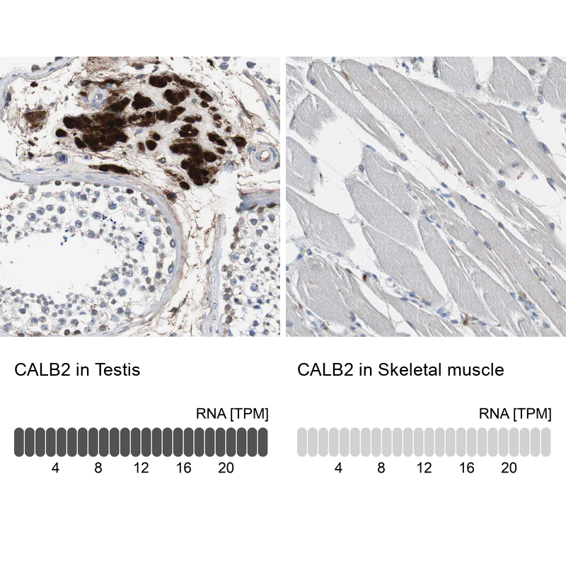 Atlas Antibodies Anti-CALB2 Antibody