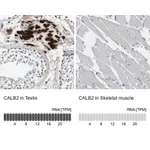 Atlas Antibodies Anti-CALB2 Antibody