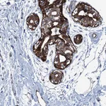 Atlas Antibodies Anti-CALCOCO1 Antibody