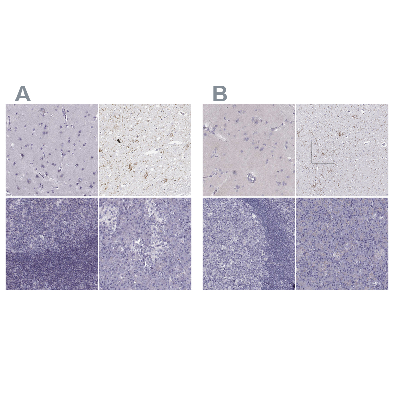 Atlas Antibodies Anti-CALCR Antibody