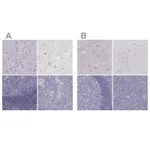 Atlas Antibodies Anti-CALCR Antibody