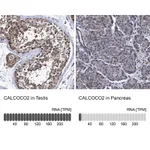 Atlas Antibodies Anti-CALCOCO2 Antibody