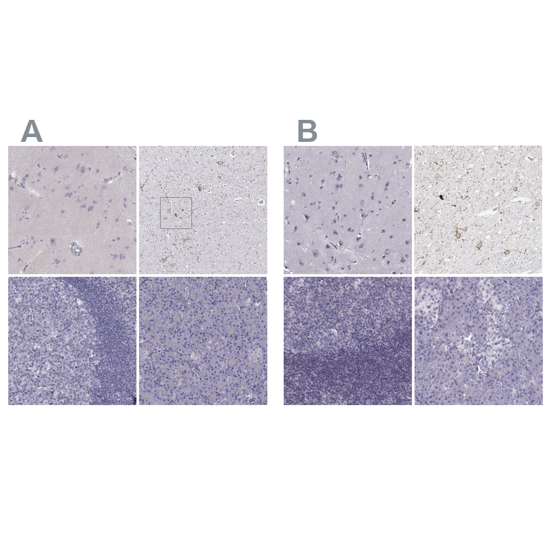 Atlas Antibodies Anti-CALCR Antibody