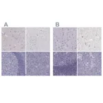 Atlas Antibodies Anti-CALCR Antibody