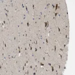 Atlas Antibodies Anti-CALHM1 Antibody