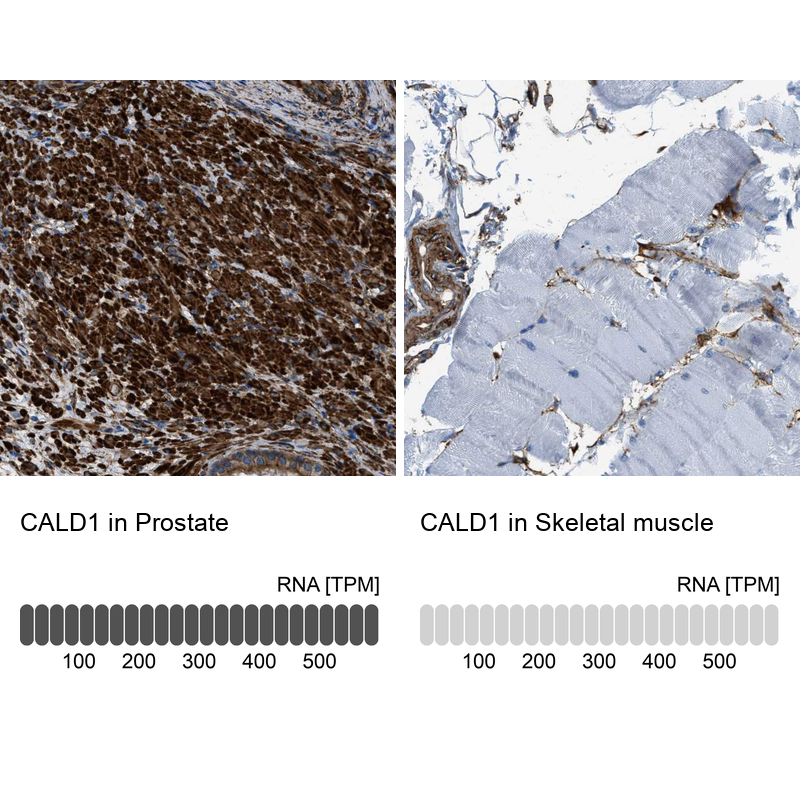 Atlas Antibodies Anti-CALD1 Antibody