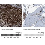 Atlas Antibodies Anti-CALD1 Antibody