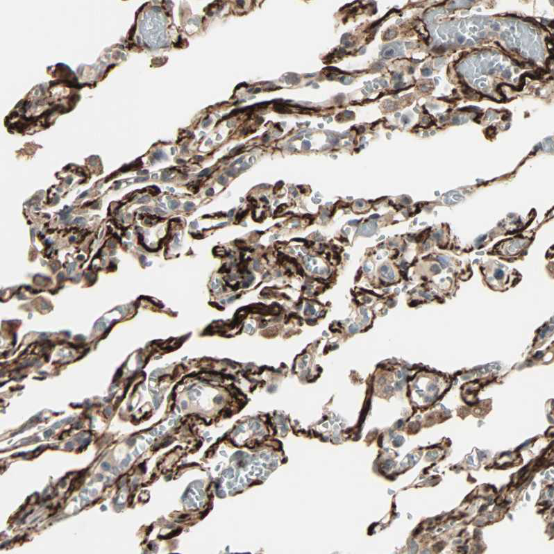 Atlas Antibodies Anti-CALCRL Antibody