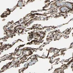 Atlas Antibodies Anti-CALCRL Antibody