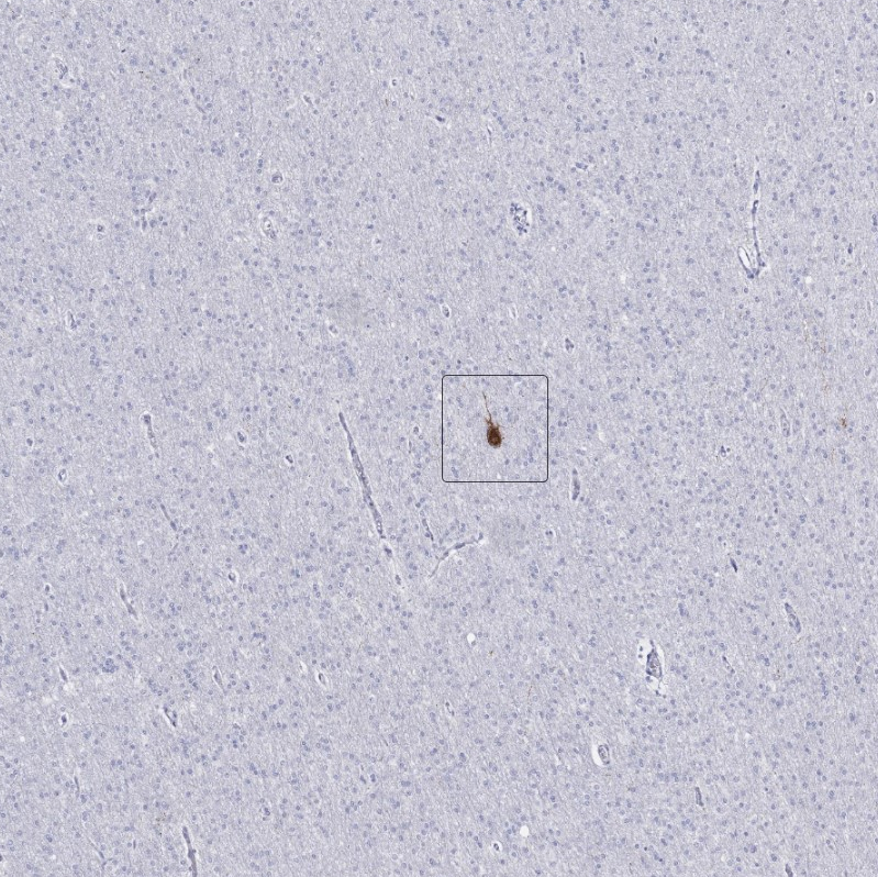 Atlas Antibodies Anti-CALHM1 Antibody
