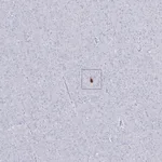 Atlas Antibodies Anti-CALHM1 Antibody