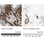 Atlas Antibodies Anti-CALD1 Antibody