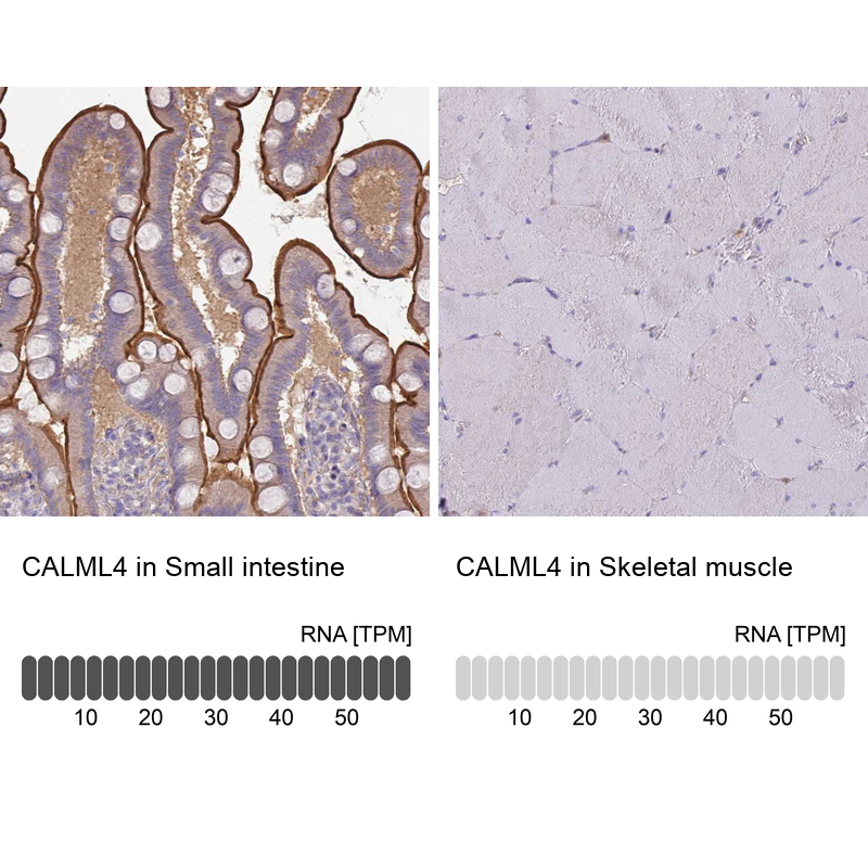 Atlas Antibodies Anti-CALML4 Antibody