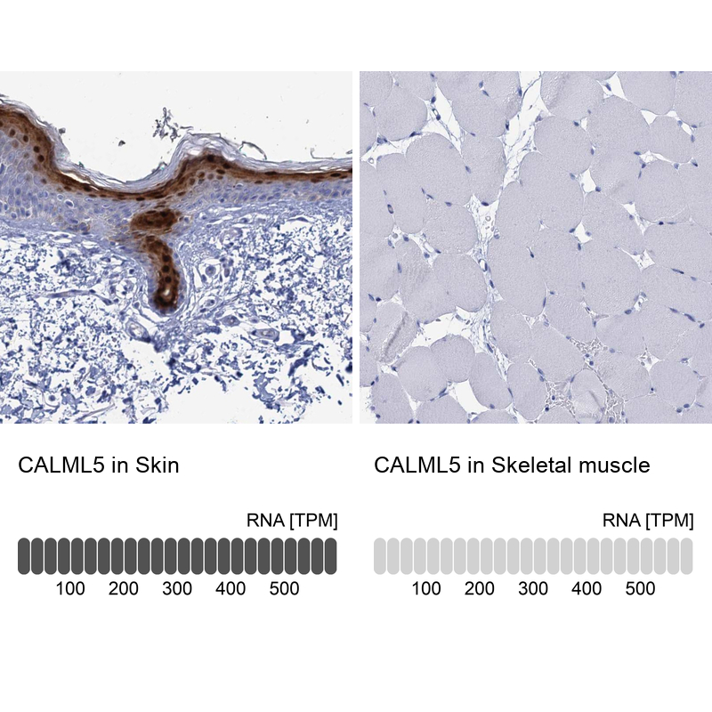 Atlas Antibodies Anti-CALML5 Antibody
