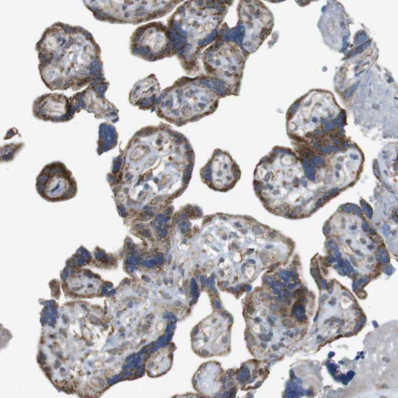 Atlas Antibodies Anti-CALHM2 Antibody