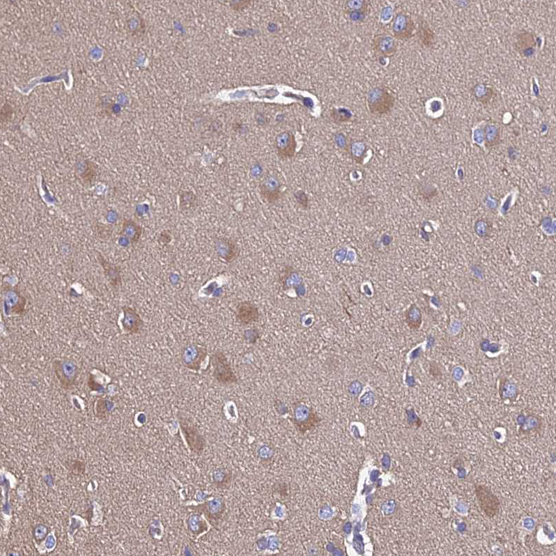 Atlas Antibodies Anti-CALM1 Antibody