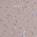 Atlas Antibodies Anti-CALM1 Antibody