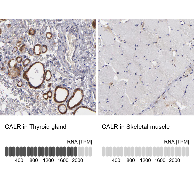 Atlas Antibodies Anti-CALR Antibody
