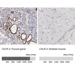 Atlas Antibodies Anti-CALR Antibody