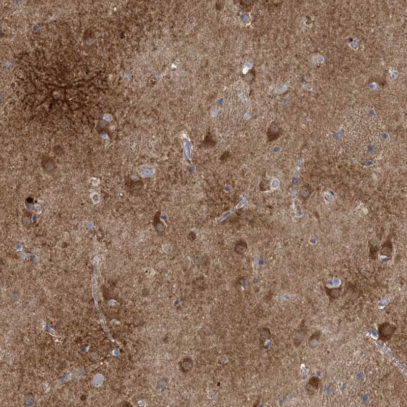 Atlas Antibodies Anti-CALN1 Antibody
