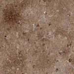 Atlas Antibodies Anti-CALN1 Antibody