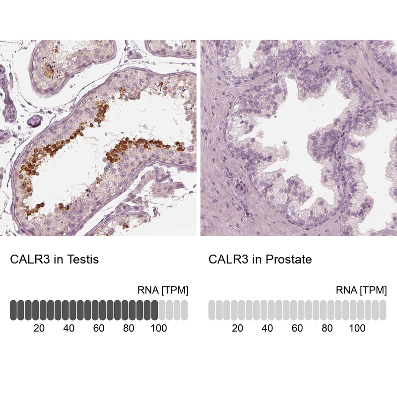 Atlas Antibodies Anti-CALR3 Antibody