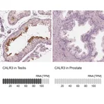 Atlas Antibodies Anti-CALR3 Antibody