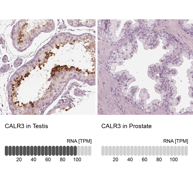 Atlas Antibodies Anti-CALR3 Antibody