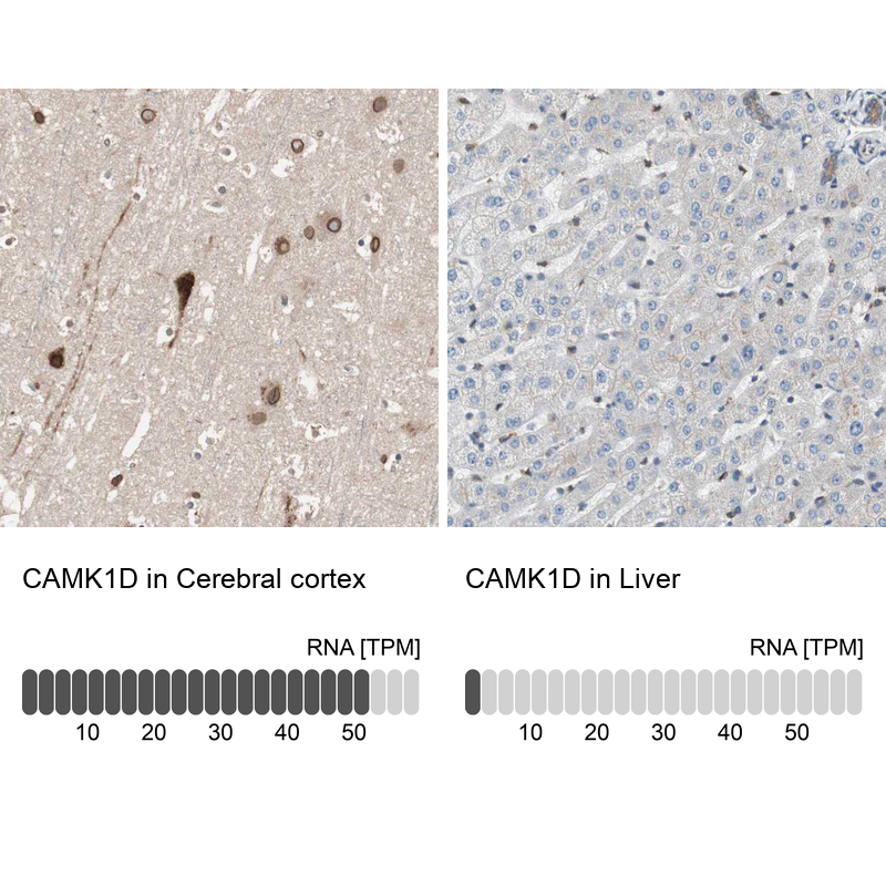Atlas Antibodies Anti-CAMK1D Antibody